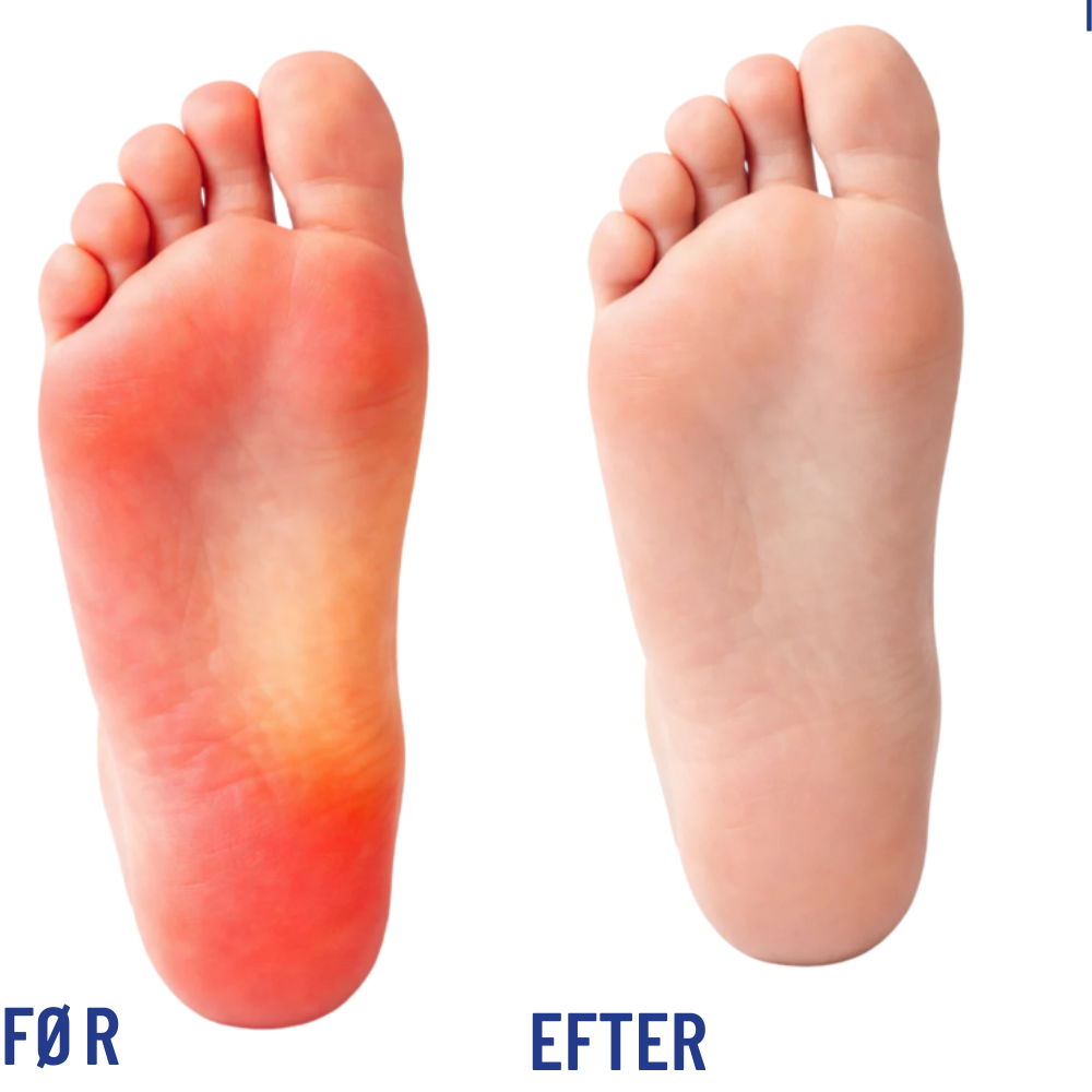 FootRevive™ | Lindr fod- og ankelsmerter derhjemme