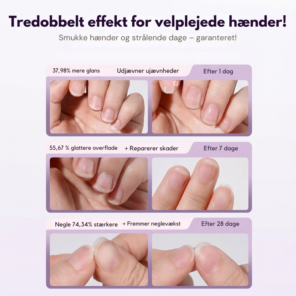 ManiSoft™ – Få pæne og velplejede neglebånd uden saks eller smerte