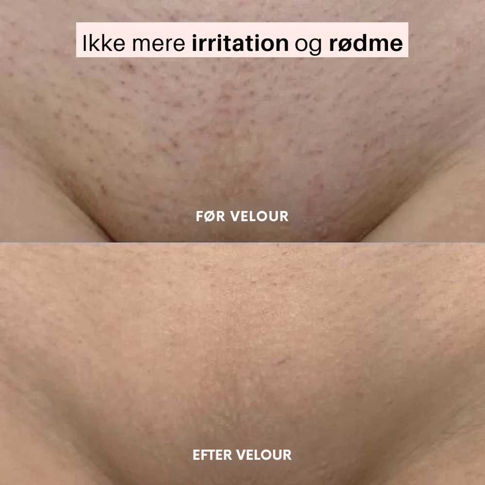 Velour™ | Blød, glat hud uden irritation
