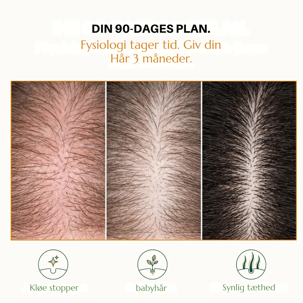 HairVital™ | Styrk dit hår indefra og oplev mere fylde igen