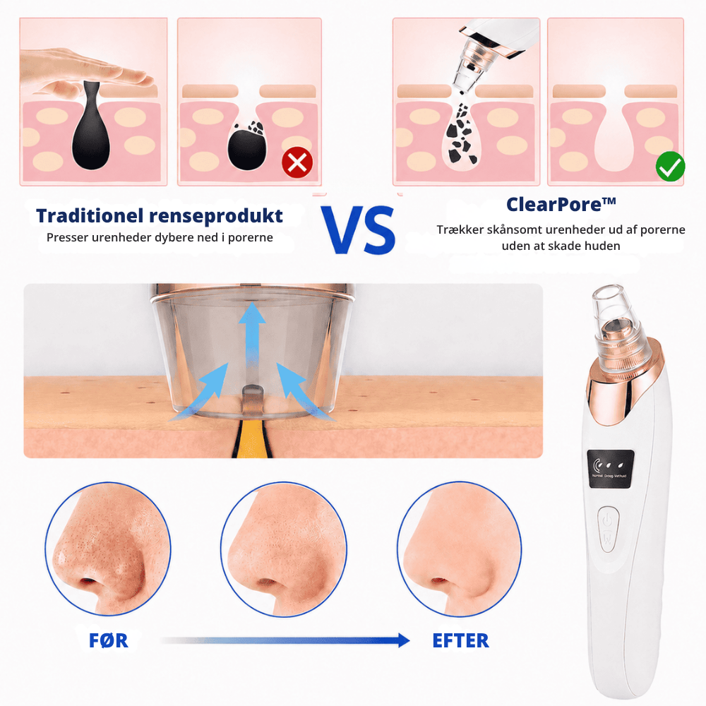 ClearPore™ | Målrettet porepleje til synligt renere hud