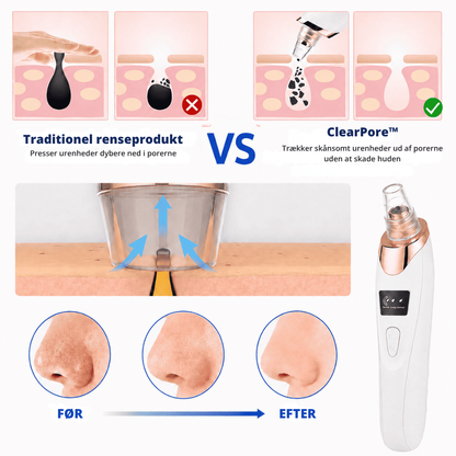 ClearPore™ | Målrettet porepleje til synligt renere hud