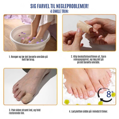 NailRepair™ | Plaster til neglesvamp