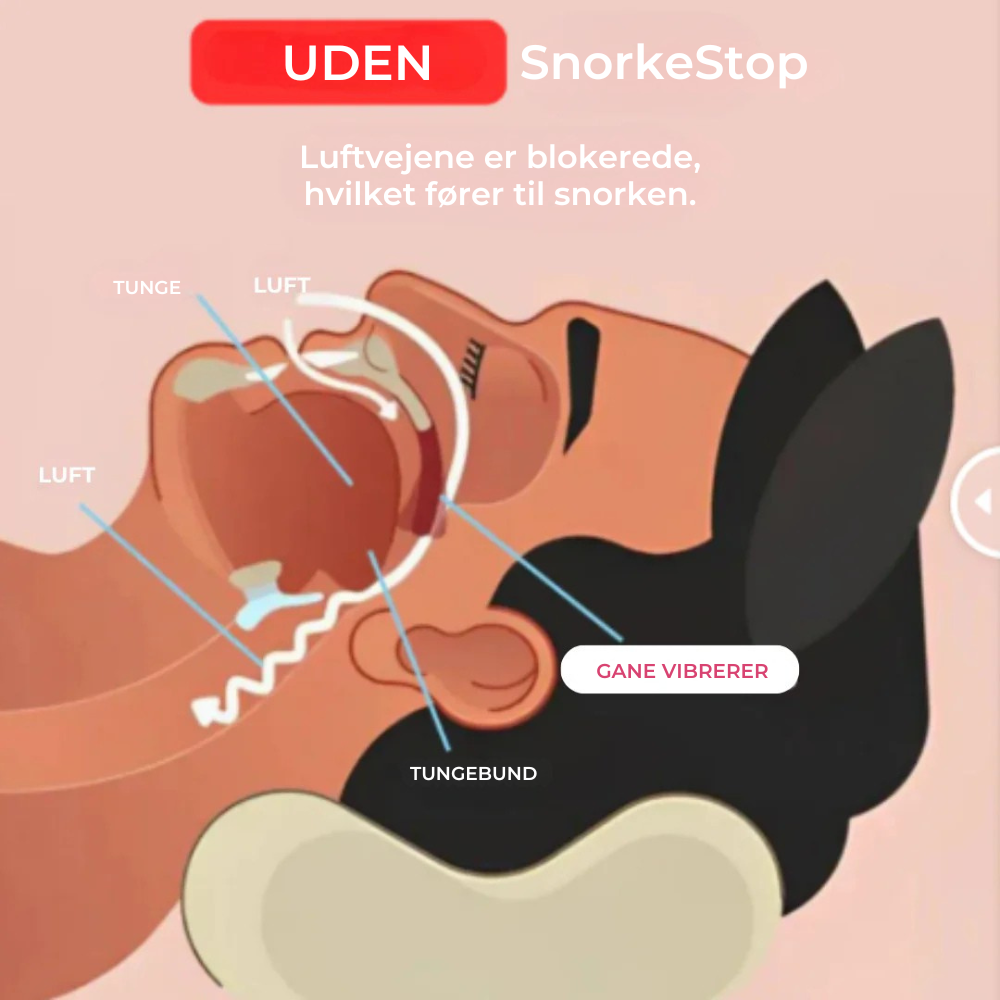 SnorkeStop™ | Få ro i soveværelset og vågn frisk og udhvilet