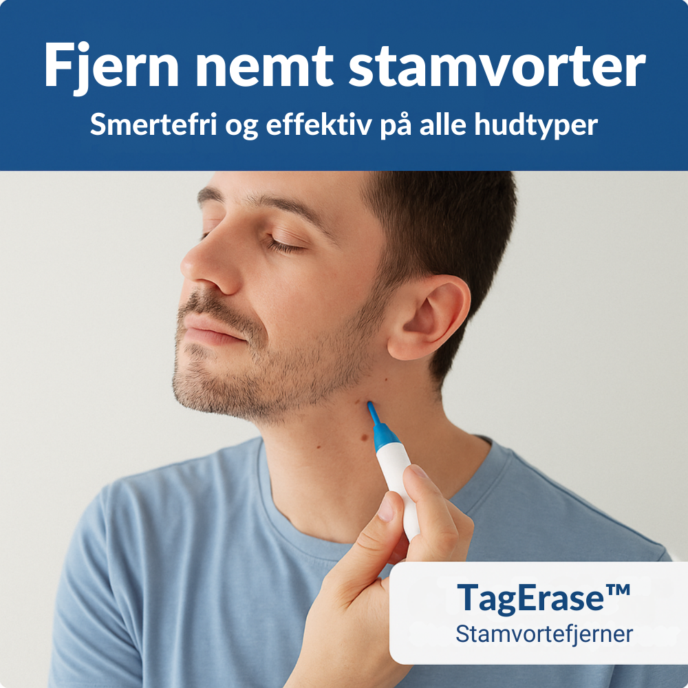 TagErase™ | Sig farvel til stamvorter