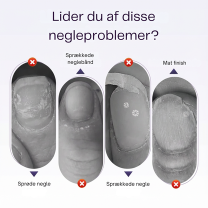 ManiSoft™ – Få pæne og velplejede neglebånd uden saks eller smerte