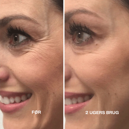 RetinLift™ | Få fastere hud og færre synlige rynker