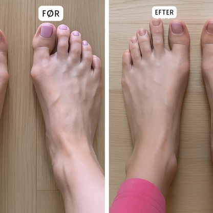 ToeAlign™ | Genskab fodens naturlige balance uden indgreb