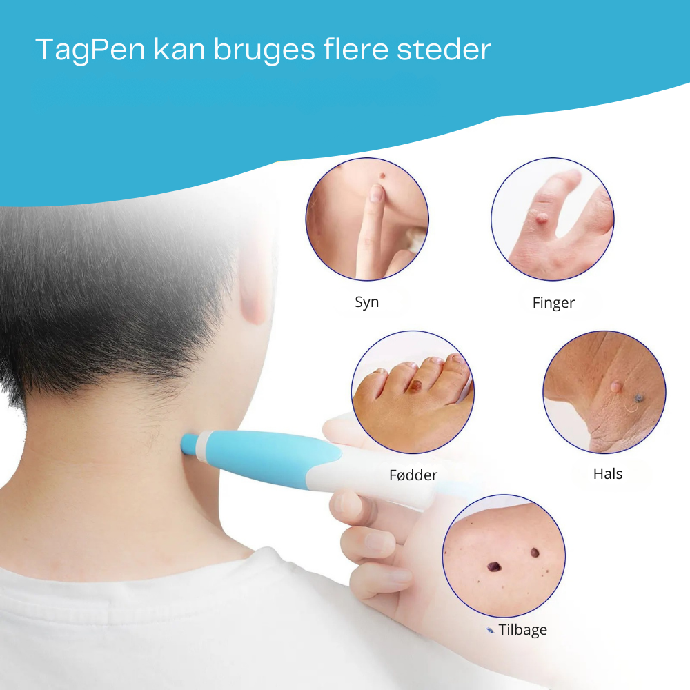 TagPen™ Kit | Fjern hudmærker nemt og skånsomt – hjemme hos dig selv