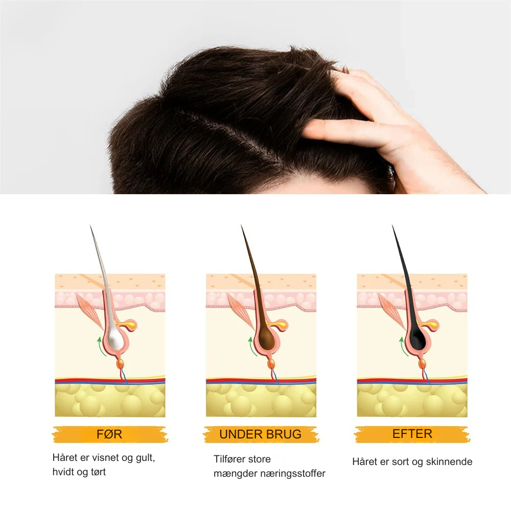 GreyGone™ | Genopret din naturlige hårfarve på den sunde måde