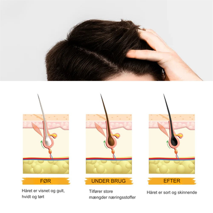 GreyGone™ | Genopret din naturlige hårfarve på den sunde måde