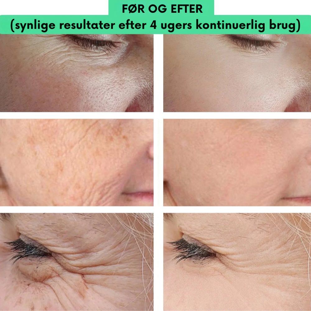 GoldenBliss™ | Giv huden den gyldne glød tilbage