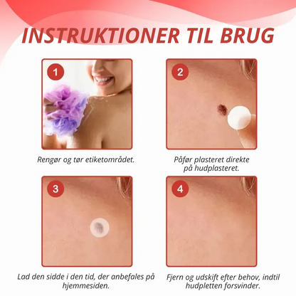DermaPatch™ | Fjern hængende vorter smertefrit – uden ar, uden snit, uden stress!