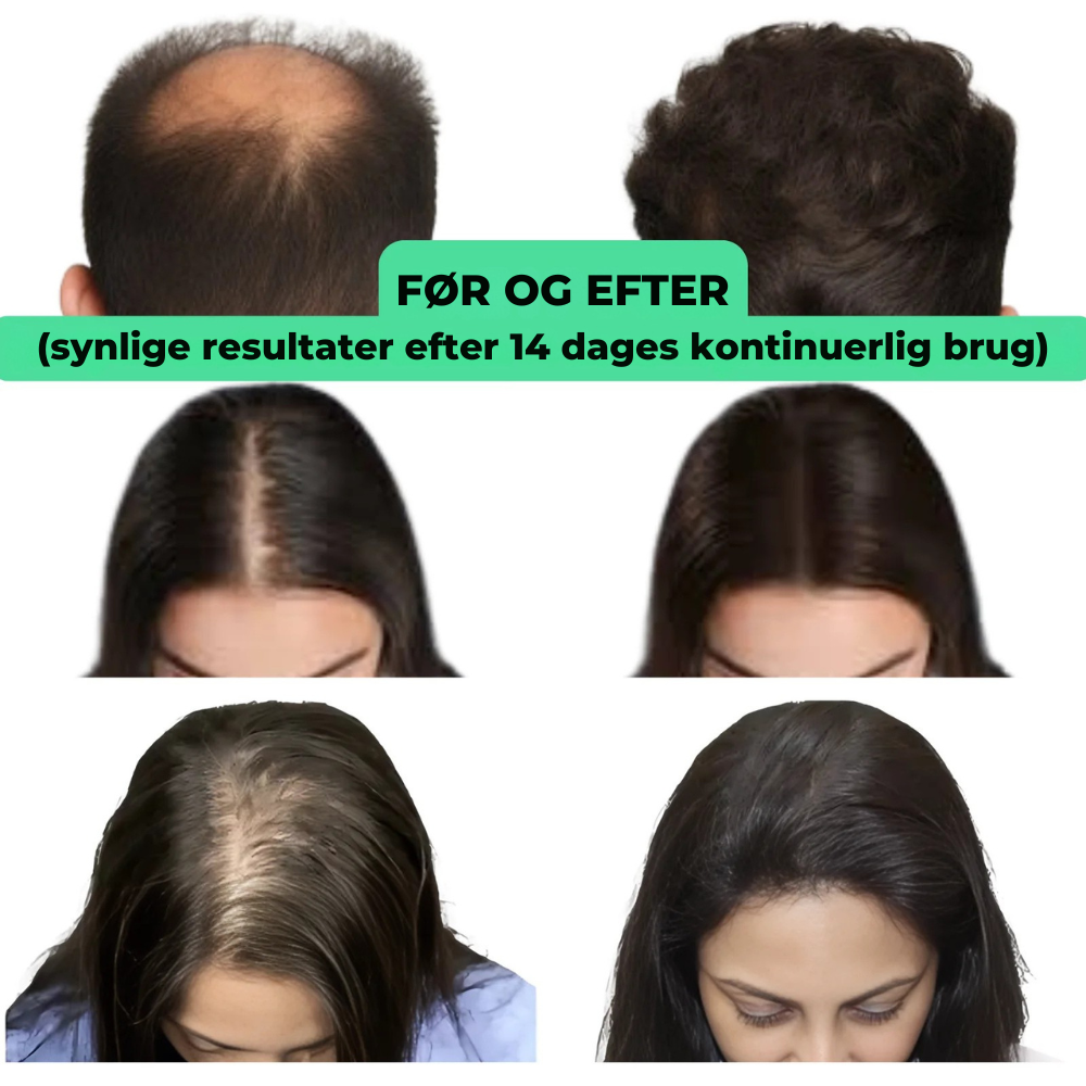RootRevive™ | Få fyldigere hår og mere selvtillid