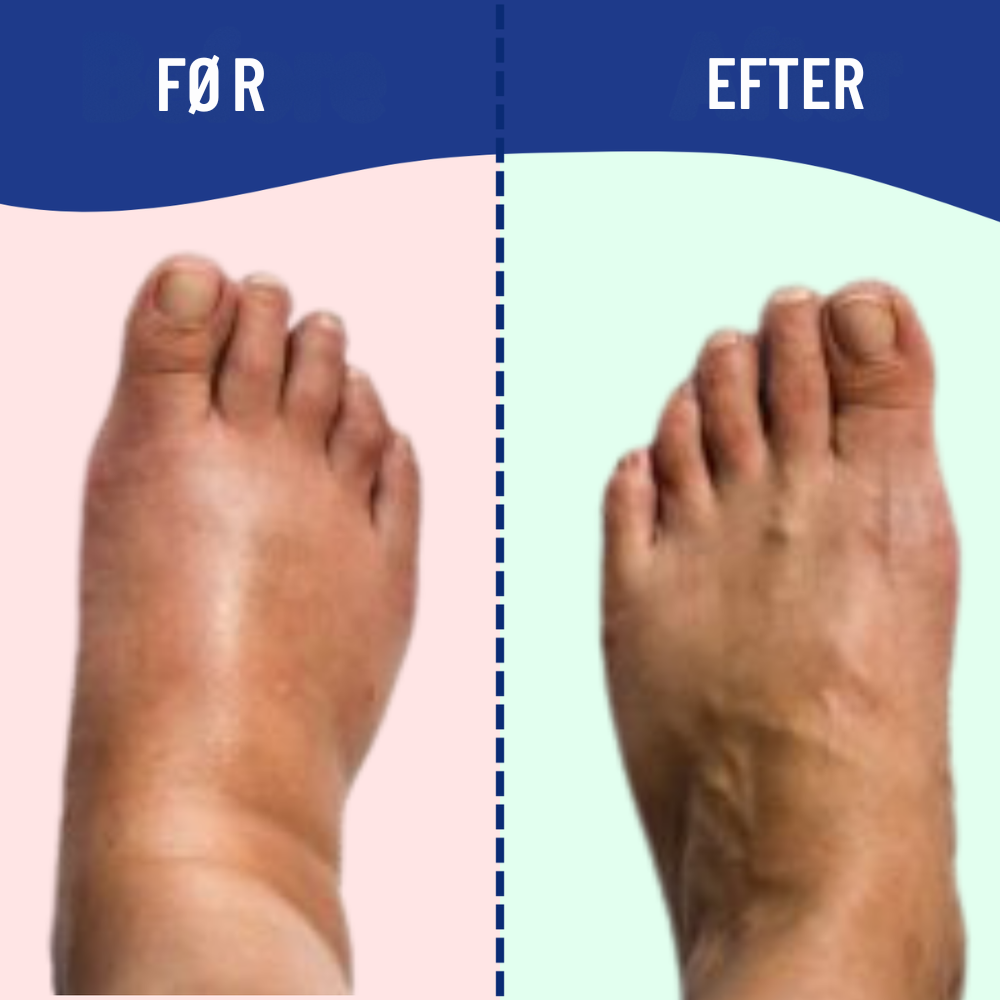 FootRevive™ | Lindr fod- og ankelsmerter derhjemme
