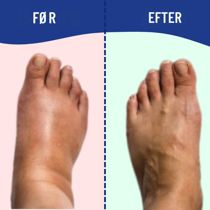 FootRevive™ | Lindr fod- og ankelsmerter derhjemme