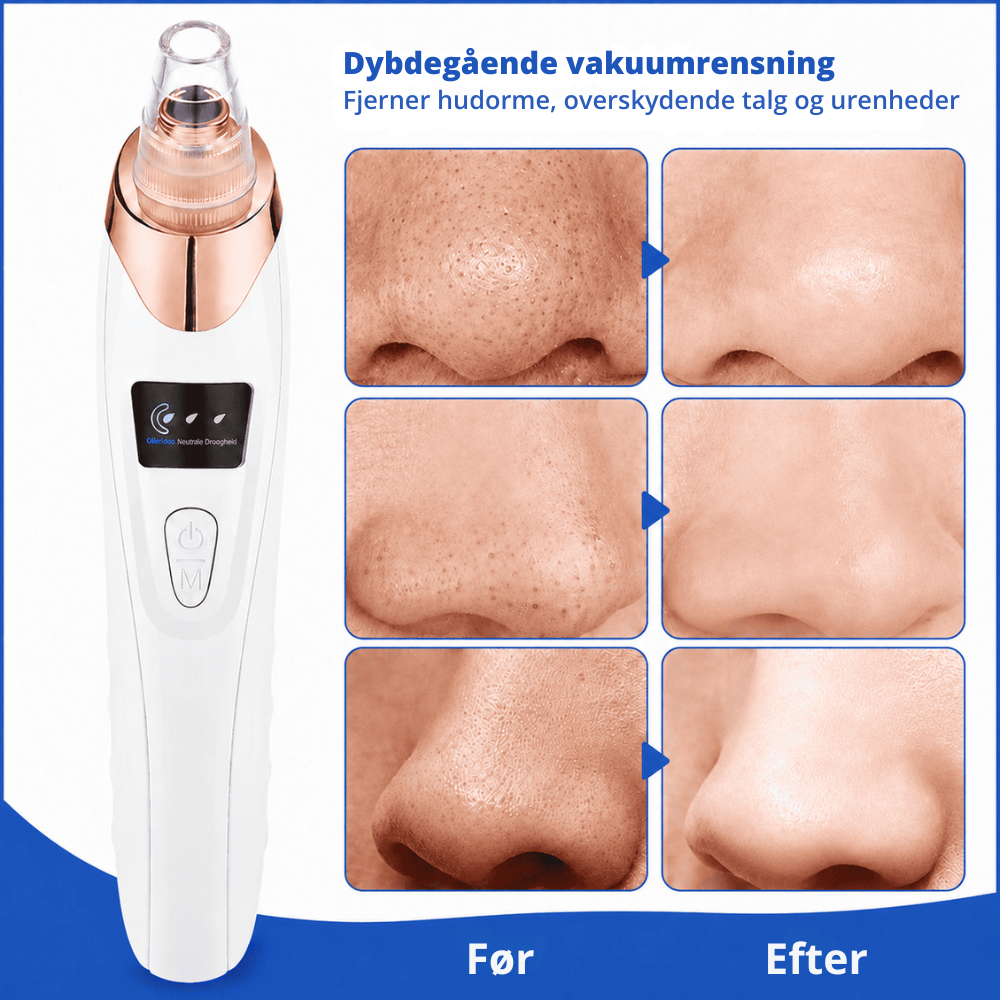 ClearPore™ | Målrettet porepleje til synligt renere hud