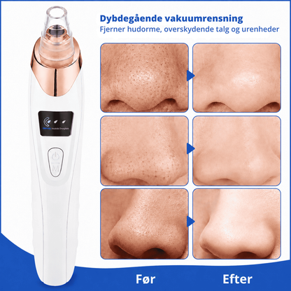 ClearPore™ | Målrettet porepleje til synligt renere hud