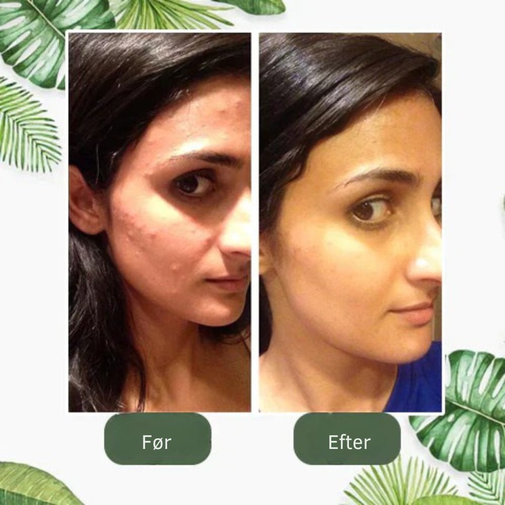 SkinRenew™ | Grøn te maske-stick – genopfrisk huden og få et yngre look