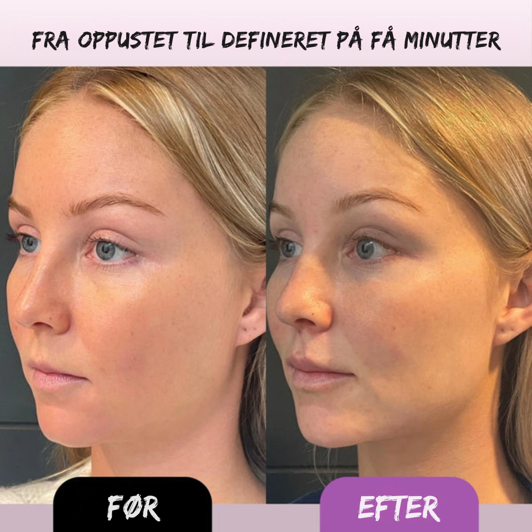 PureLift Roller™ | For en strammere, friskere hud