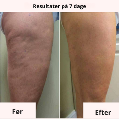 PureSculpt™ | Opstram, udglat og forny din hud – naturligt og effektivt