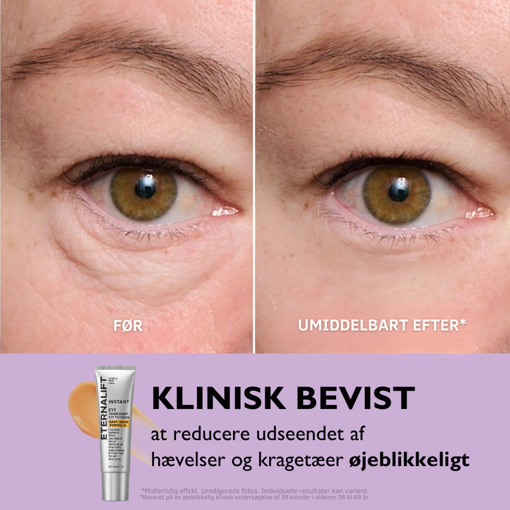 EternaLift™ | Øjencremen der fjerner poser under øjnene øjeblikkeligt og får dig til at se 10 år yngre ud