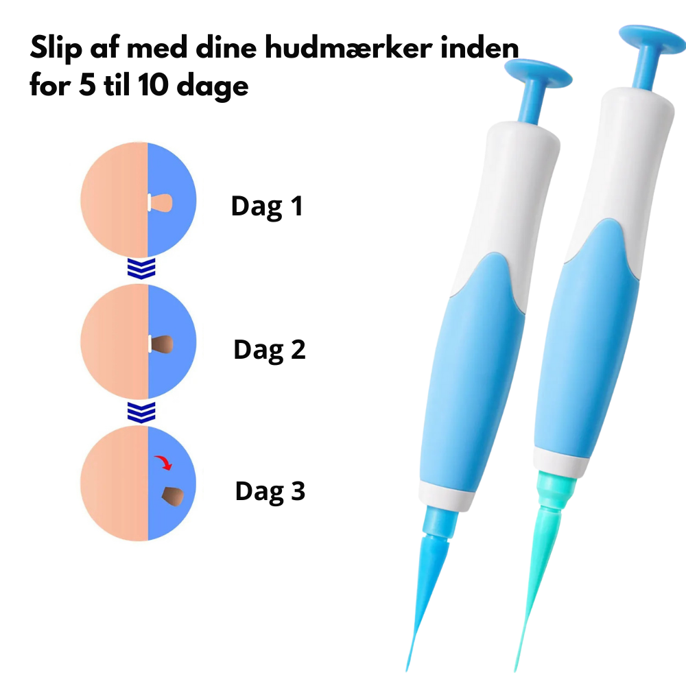 TagPen™ Kit | Fjern hudmærker nemt og skånsomt – hjemme hos dig selv
