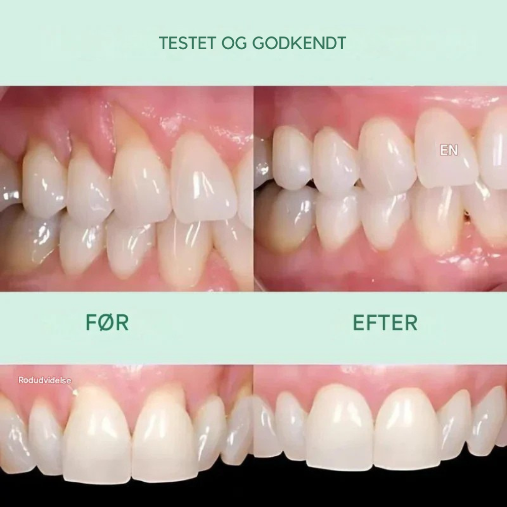 GumRevive™ | Stop blødende tandkød og genopbyg din munds sundhed – naturligt