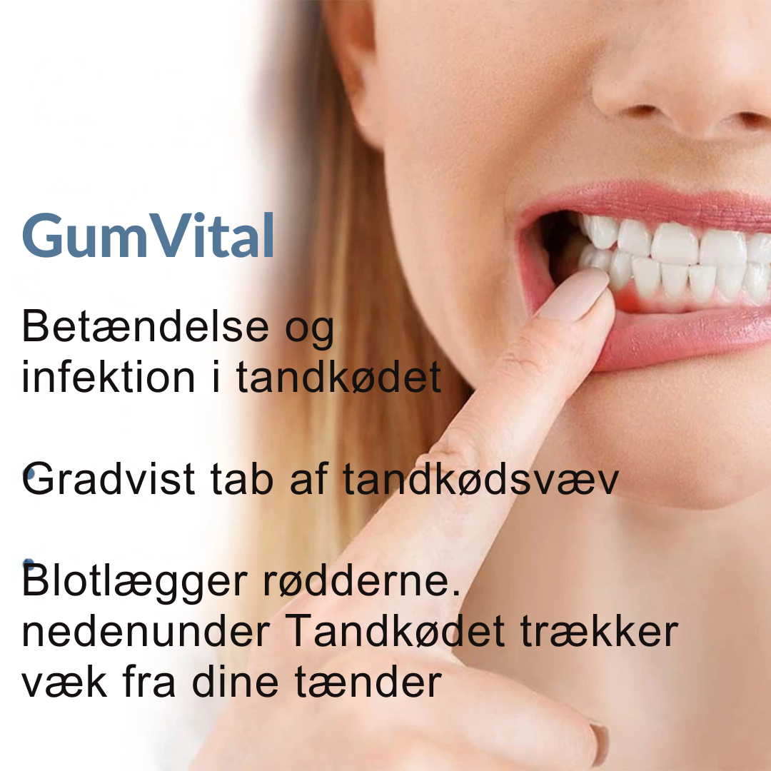 GumVital™ | Synlig bedring af tandkødet på 93%!