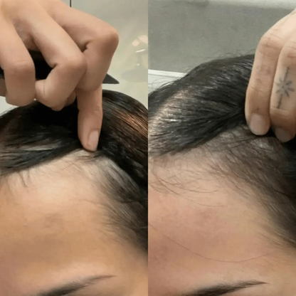 HairVital™ | Styrk dit hår indefra og oplev mere fylde igen