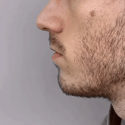 RhinoClear™ | Næsebehandling - Ånd Frit Igen