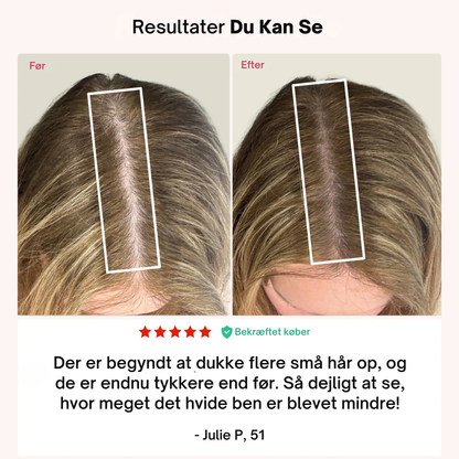 LumiCap™ | Støt stærkere hårvækst hjemmefra