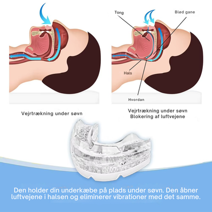 SomnoCalm™ | Sov roligt igen uden snorken der forstyrrer natten
