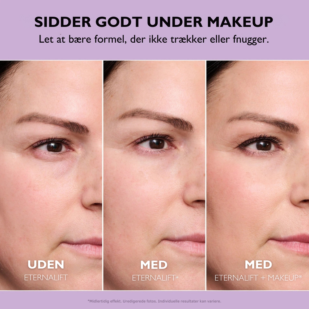 EternaLift™ | Øjencremen der fjerner poser under øjnene øjeblikkeligt og får dig til at se 10 år yngre ud