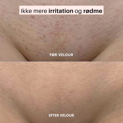 Velour™ | Blød, glat hud uden irritation