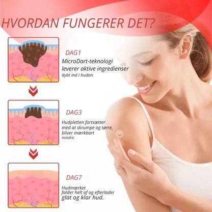 DermaPatch™ | Fjern hængende vorter smertefrit – uden ar, uden snit, uden stress!