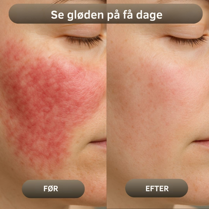 NaturaBalm™ | Den naturlige fugt, din hud har længtes efter