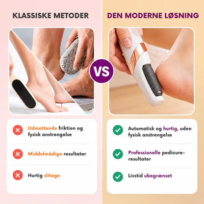 PediSmooth™ | Elektrisk fodpleje til bløde velplejede hæle hjemme