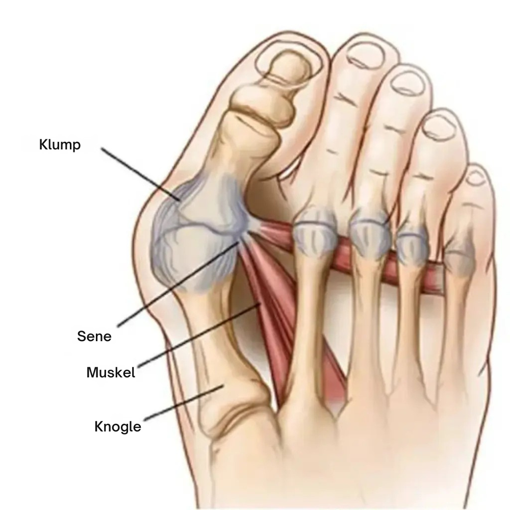 ToeAlign™ | Genskab fodens naturlige balance uden indgreb