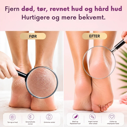 PediSmooth™ | Elektrisk fodpleje til bløde velplejede hæle hjemme