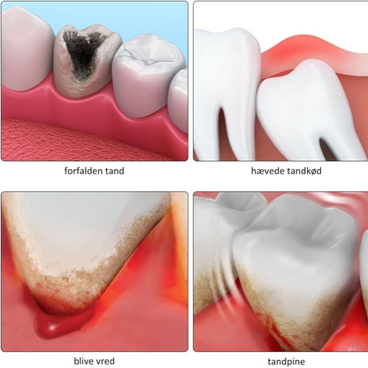 DentaRelief™ | Lindr smerte og irritation på få minutter – naturligt og sikkert