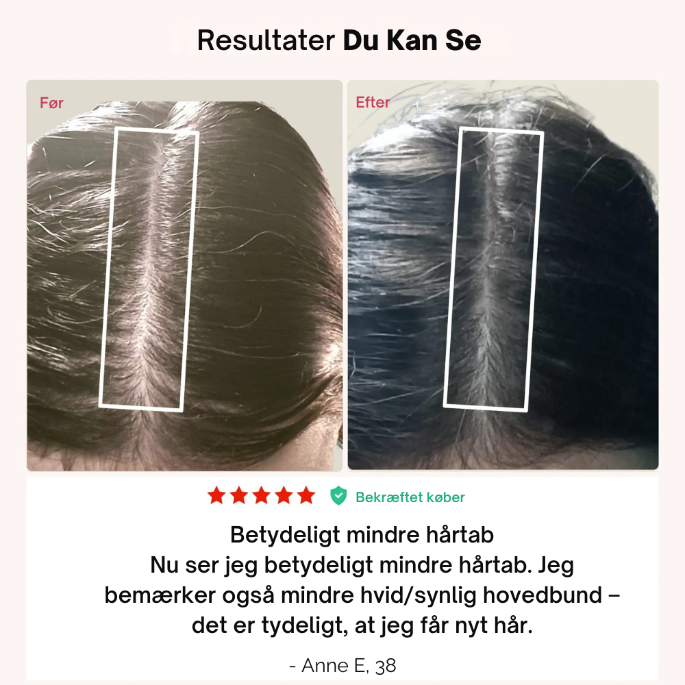 LumiCap™ | Støt stærkere hårvækst hjemmefra