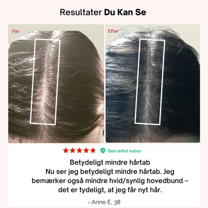 LumiCap™ | Støt stærkere hårvækst hjemmefra