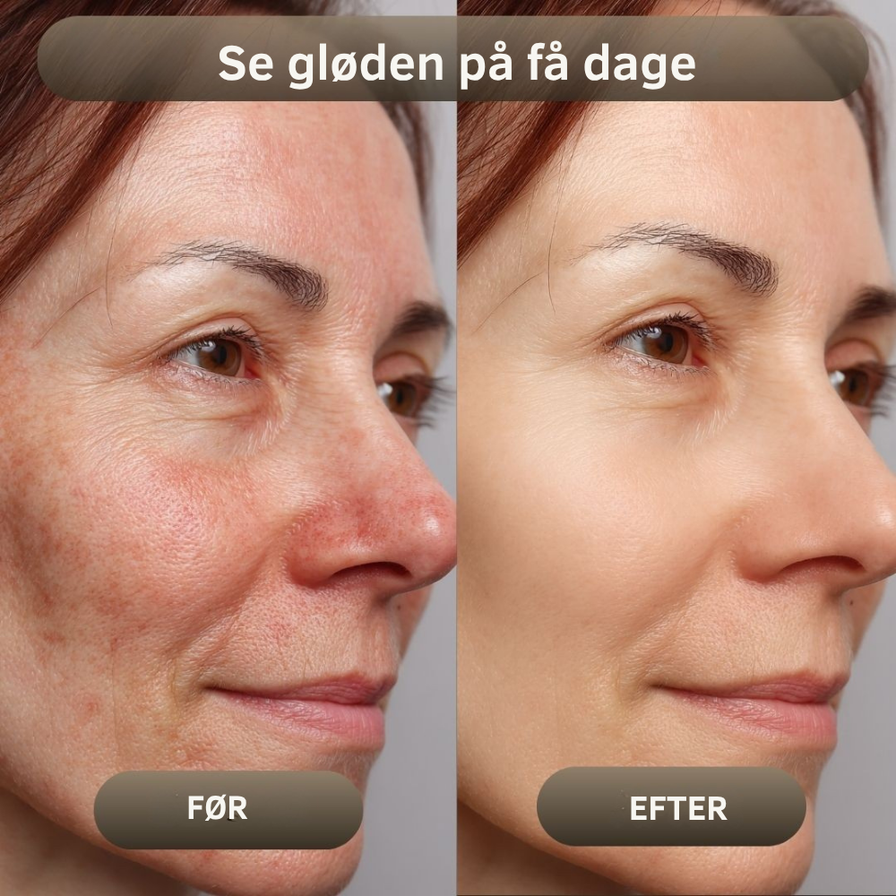 NaturaBalm™ | Den naturlige fugt, din hud har længtes efter