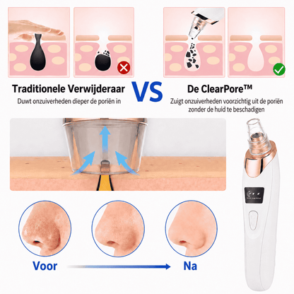 ClearPore™ | Målrettet porepleje til synligt renere hud