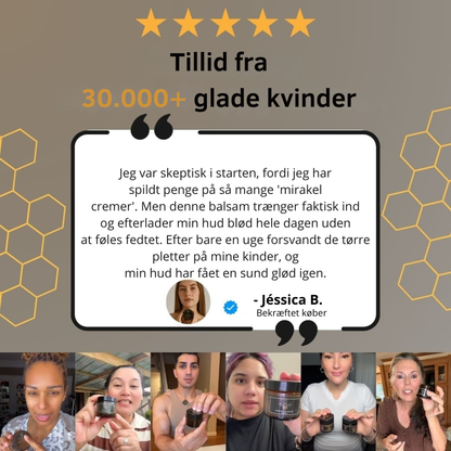 NaturaBalm™ | Den naturlige fugt, din hud har længtes efter