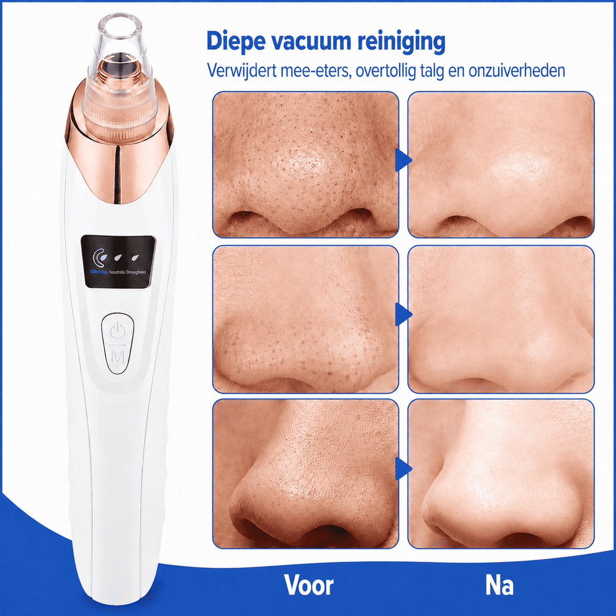 ClearPore™ | Målrettet porepleje til synligt renere hud