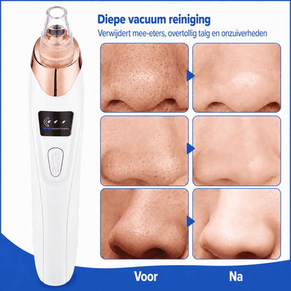 ClearPore™ | Målrettet porepleje til synligt renere hud