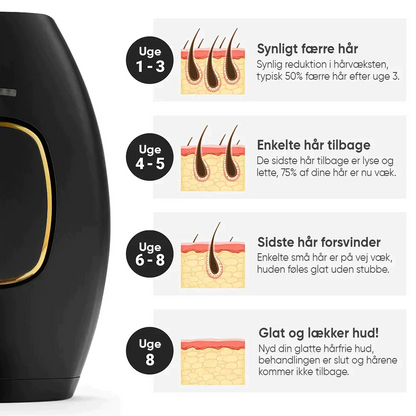 SmoothTouch™ IPL | Permanent hårfjerning – skånsom teknologi til glat hud hele året