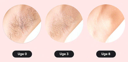 SmoothTouch™ IPL | Permanent hårfjerning – skånsom teknologi til glat hud hele året